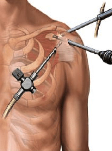 Sports Injury