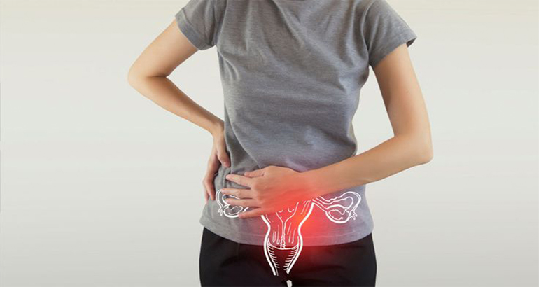 Hysterectomy