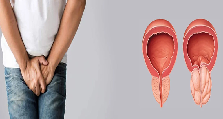 Prostate
