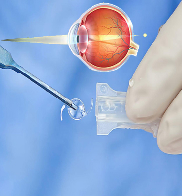Multifocal IOLs
